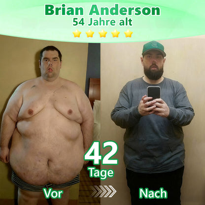 30 % zusätzlicher Rabatt auf reduzierte Artikel! | Offizieller Shop | Murwon® 6-in-1 Nano-Mikronadel-Patch Fit & Vital mit NAD+ und Berberin (einmal täglich, sichtbare Veränderungen in 7 Tagen)