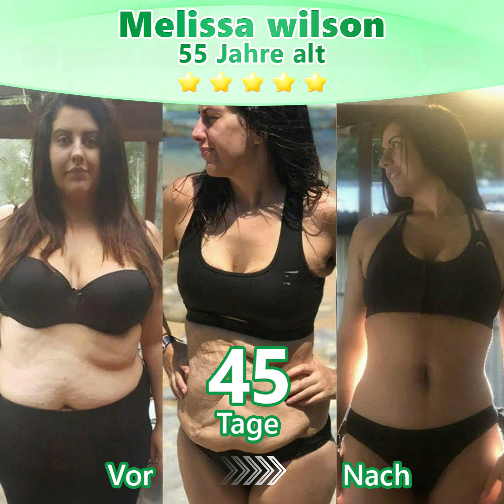 30 % zusätzlicher Rabatt auf reduzierte Artikel! | Offizieller Shop | Murwon® 6-in-1 Nano-Mikronadel-Patch Fit & Vital mit NAD+ und Berberin (einmal täglich, sichtbare Veränderungen in 7 Tagen)